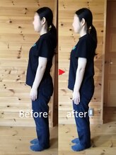 メリッサ接骨 整体院/反り腰改善、お任せください！