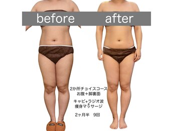 サロン ド ミコ(Salon de Mico)/40代　2か所チョイスコース