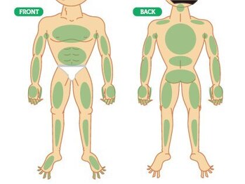 イエス 大阪梅田店(YES)/全身脱毛・VIO脱毛・ヒゲ脱毛