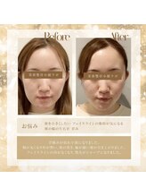 美容整骨小顔ラボ/ビフォーアフター