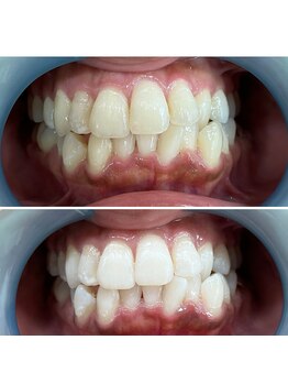 シャイニー 仙台駅東口(SHINY)/お客様の変化
