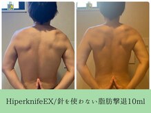 ソルニスデュオ(Solnis.-duo-)/痩身/酵素浴/毛穴/よもぎ蒸し