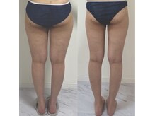 プリマルーチェ/プレミアム下半身プログラム