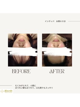 グランツ 小山店/インディバフェイシャル60分