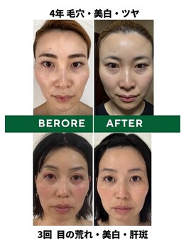 よもぐるみ/ビフォーアフター