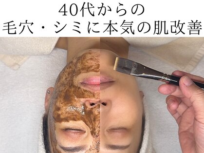 ミーツ(Meets)の写真