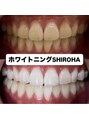 シロハ(SHIROHA) セルフホワイトニング/大阪/天王寺/小顔/ホワイトニング/美白