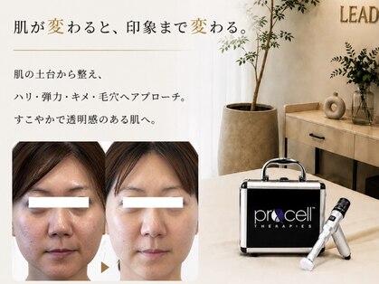 リードスラッシュ(LEAD/)の写真