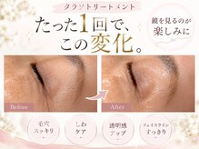 アンドミラー(And Mirror)の雰囲気（リアボーテ認定サロン☆本格肌育成[ハーブピーリング/シミケア]）
