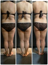 ラクラク(rakuraku)/痩身【全身】1～5回目