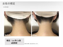 リネ(Rine)/before→after