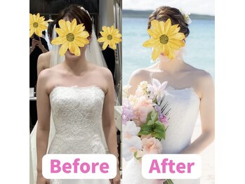 ボディキュア ブライダル美容整体 大阪梅田/デコルテラインがすっきり★