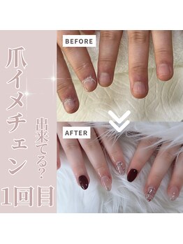 アンドネイルアンドビューティー(&NAIL and Beauty)/爪悩み・噛み爪・美爪育成
