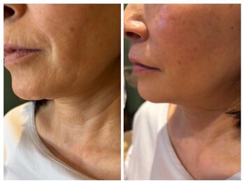 ペリドット(Peridot)/