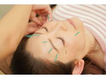 桂東洋鍼灸整骨院/美容鍼鍼灸施術