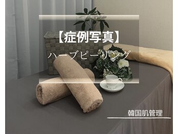 ホワイトアクア 北千住店(WHITE AQUA)/ハーブピーリング施術前後の写真