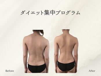 ホリスティックサロン ヘルバ(Holistic salon Herba)/ダイエット施術変化