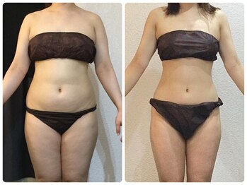 ウェリナ平和堂長久手院/.【ダイエットbefore→after】