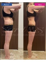 シャトン ボーテ(chaton beaute)/スラッとボディラインに♪