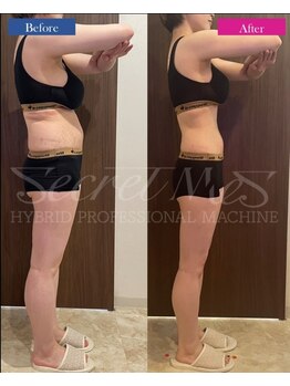 シャトン ボーテ(chaton beaute)/スラッとボディラインに♪