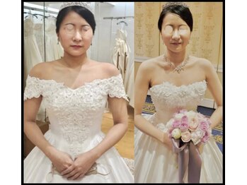 ソウ バイ ソウ(So by 蒼)/骨から整える、究極の痩身術。