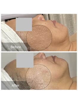 カノン(Kanon)/くすみ肌から透明感ある垢抜け肌