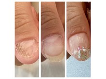 数ヶ月後にはネイルもお楽しみいただけます