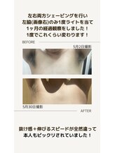 ロエル 出雲(RoELe)/一回での変化（メンズ）