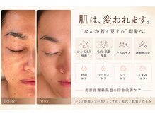 アールヨンマルハチ フェイスアンドアイ(R408.face&eye)