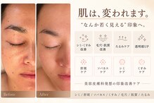 アールヨンマルハチ フェイスアンドアイ(R408.face&eye)