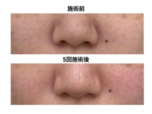 ロルク鍼灸整骨院の雰囲気（続けて施術するとより効果的です。）
