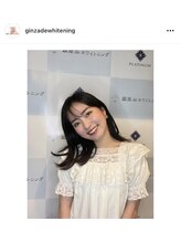 銀座deホワイトニング　/【有名人、モデルも多数ご来店】