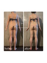 ボーレーヴ 表参道店(beaureve)/施術効果写真（before after）
