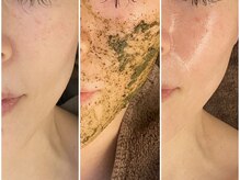 美顔研究所 バイ ヴィヴセカンド(美顔研究所 by viv 2nd)/