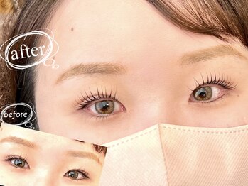 ベロニカ(Beronica)/上下ラッシュリフトでぱっちり