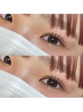 リアル(REAL)/上下ラッシュリフト