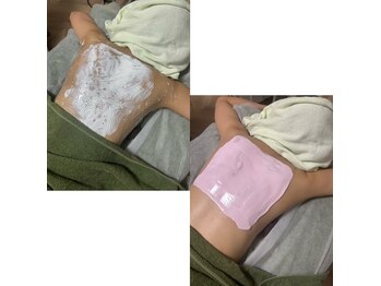 アモ(amo.)/背中美肌ケア