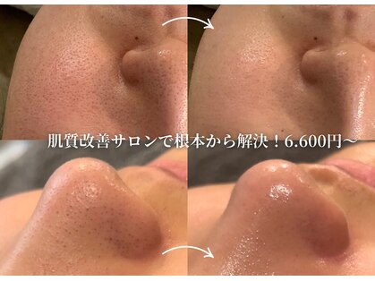 リジュ(Reje)の写真