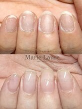 マリーロール 梅田店(Marie Laure)/深爪矯正/自爪育成/ネイルケア
