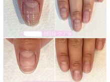リリー(Lilly)/ネイルケアで自爪育成
