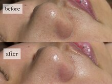 ヒナノ 矢場町店(HINANO)/クリスティーナビオフィート