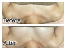 ハナハナ(hanahana)/