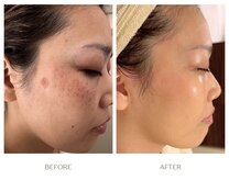 ラシェプリズ(LACHER PRISE)