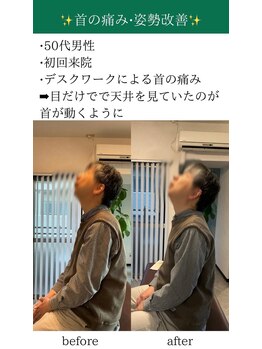 オルカ整体院(ORCA整体院)/【鹿児島/肩こり】