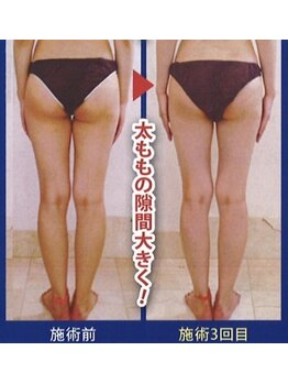 ヴィエーゾ(VIESO)/ハイパーナイフ 3回の効果！