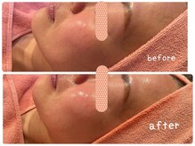 ヒメミ(Himemi)/艶肌Ｗａｘ