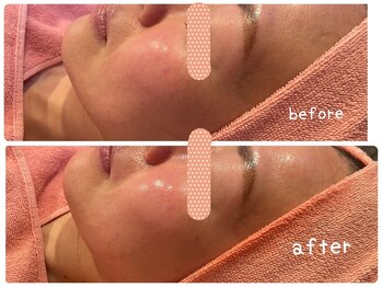 ヒメミ(Himemi)/艶肌Wax