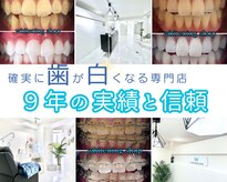 ホワイトニングショップ 千葉店