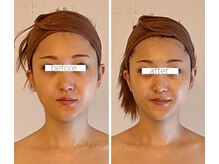 パル コルギサロン(Pal. Korugi salon)/コルギビフォーアフター