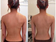 ミールーム(mi room)/痩身エステ４ヶ月